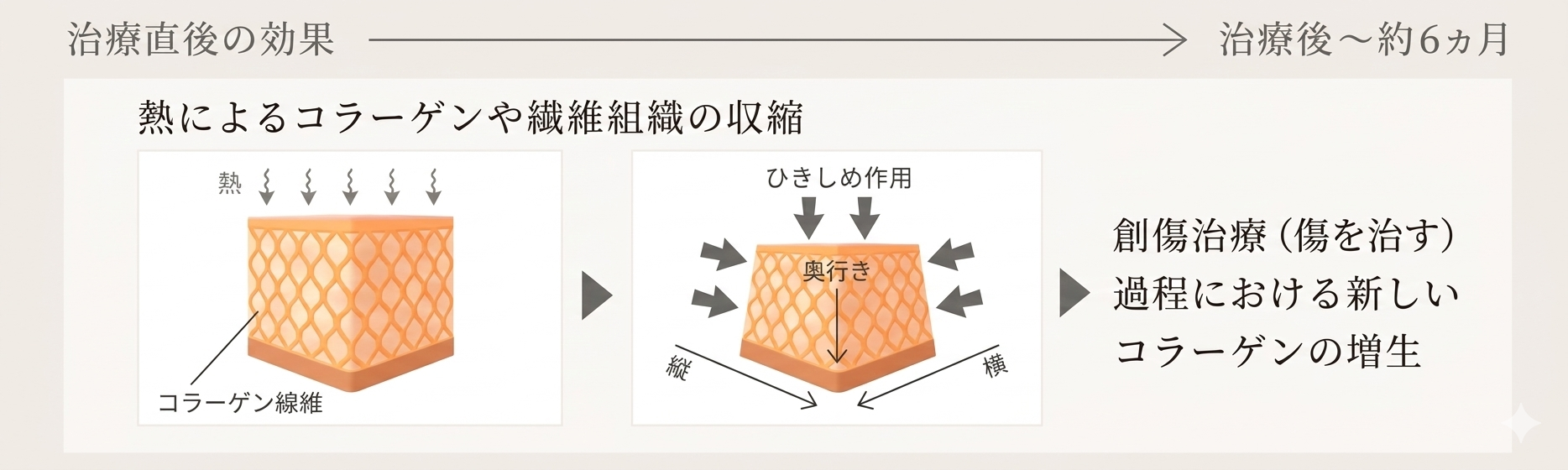 サーマクールアイの仕組み図。