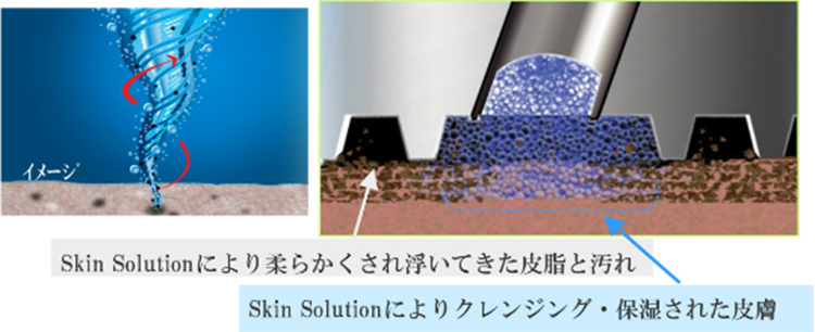 Skin Solutionにより柔らかくされ浮いてきた皮脂と汚れ / Skin Solutionによりクレンジング・保湿された皮膚