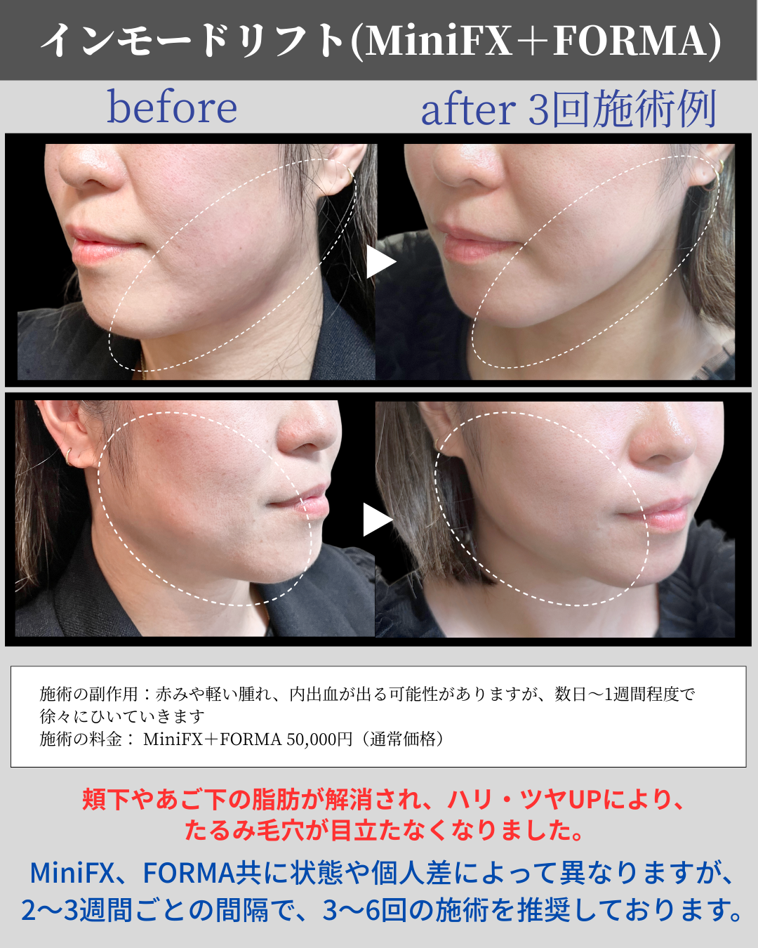 26年2月マンスリーインスタ (9).png