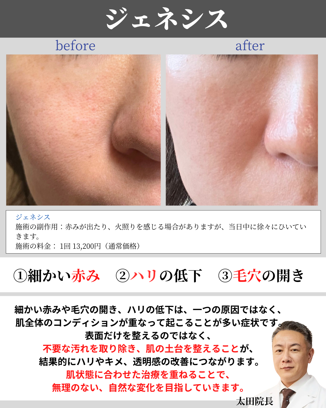 26年2月マンスリーインスタ (6).png