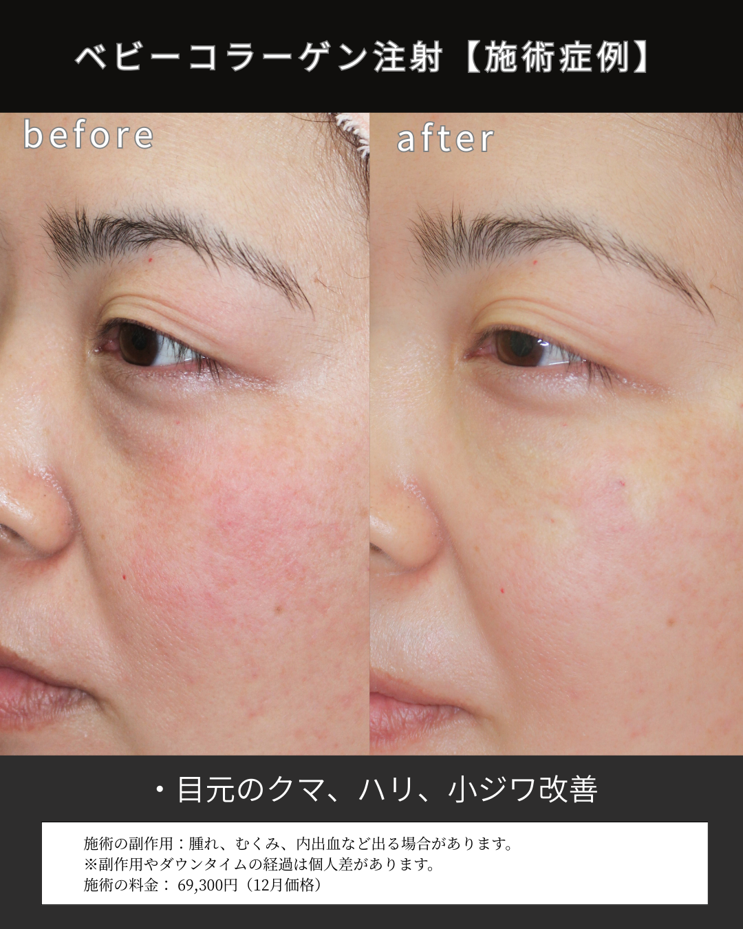 １２月マンスリー (4).png