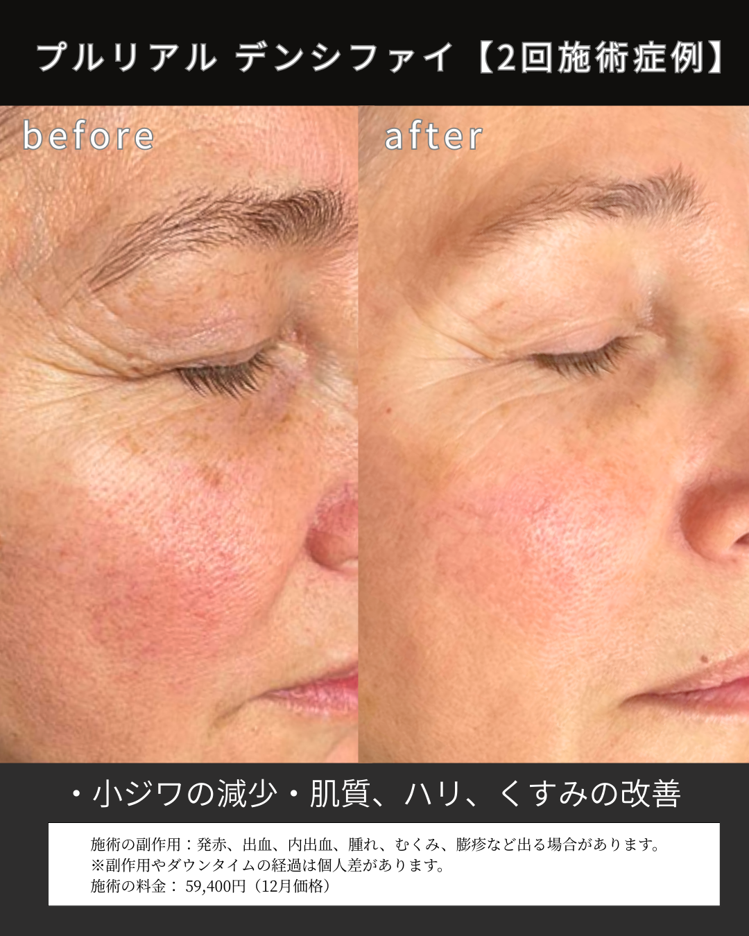 １２月マンスリー (2).png