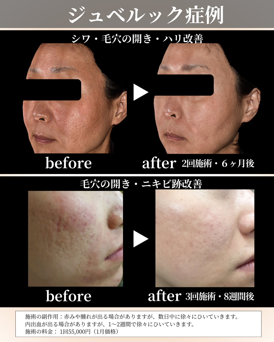 １月マンスリー (7).png