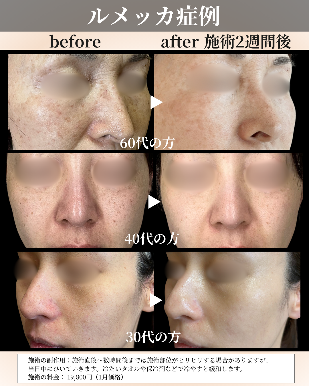 １月マンスリー (3).png