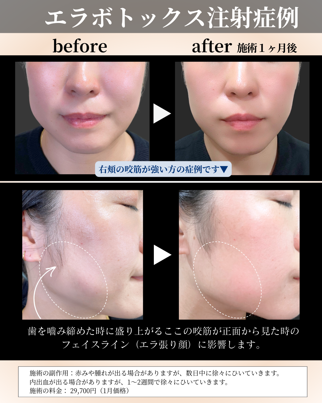 １月マンスリー (5).png